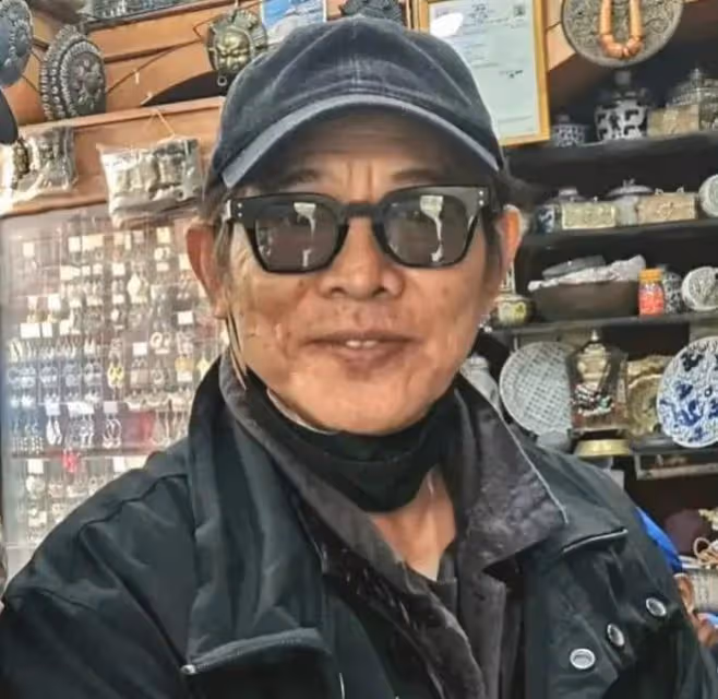 男星暴瘦後也一言難盡，皮包骨，筷子腿，蒼老10歲，面相都變了