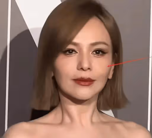 雪姨王琳通過醫美變回24歲,網友調侃:無人不老,美圖秀秀來幫你