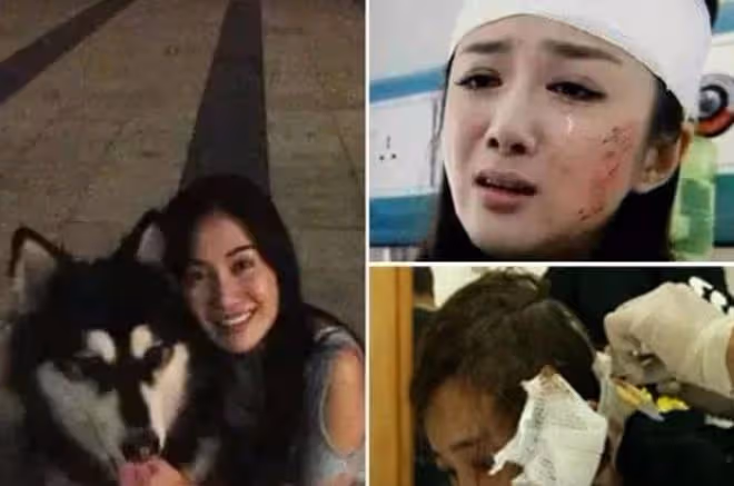曾是古裝第一美人，被狗咬後瘋狂整容，只能演繹惡毒女配