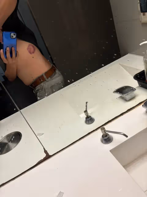 超衰！《愛的榮耀》男星看球賽遭界外球砸中　　傷勢曝光打算買樂透