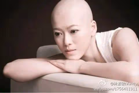 TVB女演員曾患乳癌頭髮掉光，抗癌成功積極面對生活，憑演技贏得讚賞