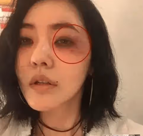 笑不活了!小S屢次被家暴,網友反倒心疼許雅鈞的手疼不疼!
