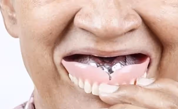 掉牙和壽命有關?55歲的人,牙齒剩多少算正常?看看你達標嗎?