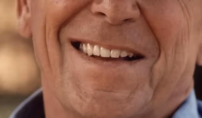 掉牙和壽命有關?55歲的人,牙齒剩多少算正常?看看你達標嗎?