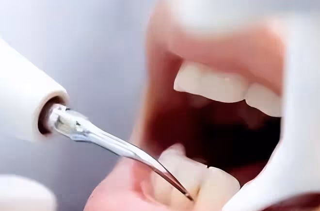 掉牙和壽命有關?55歲的人,牙齒剩多少算正常?看看你達標嗎?