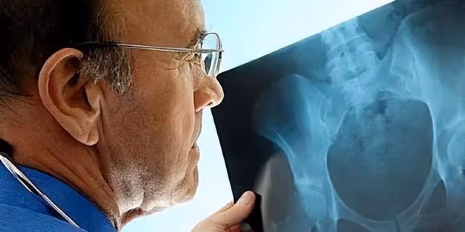喝酒把骨頭喝壞死了?這些症狀別忽略,喝酒不傷身,關鍵在這個數