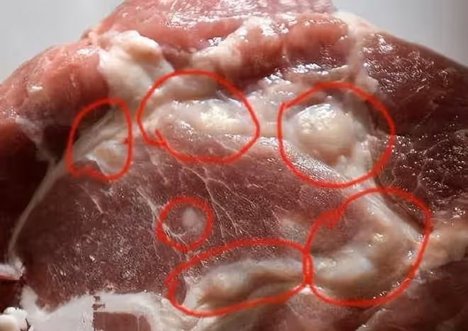 體內有癌,脖子先知?提醒:脖子出現2個異常,小心是癌症找上門