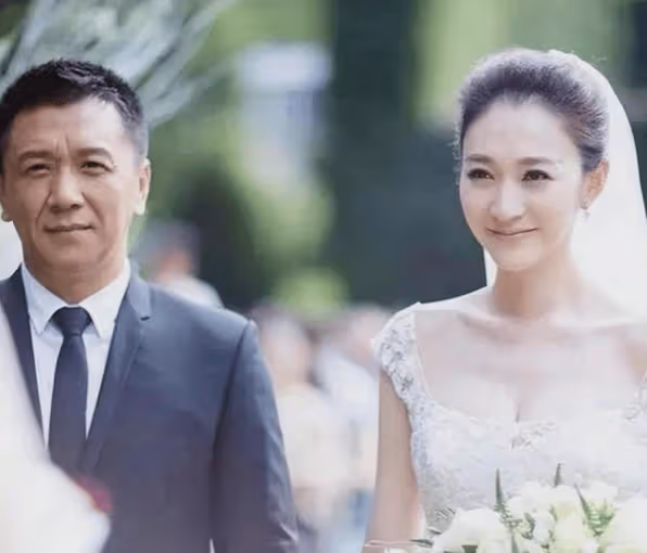 李小冉的面容像吃了防腐劑似的，老公給他五億也不做醫美