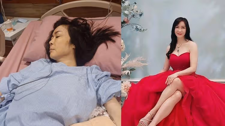 女星顧婕直腸癌「擴散到肝臟」　病情變棘手