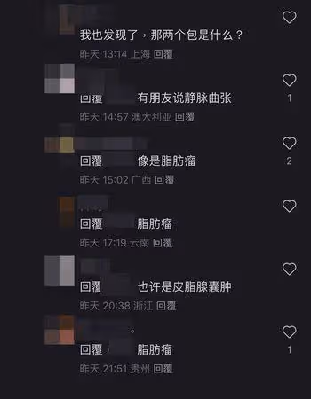 周潤發太平山跑步「大腿冒出2腫包」 網憂1病症纏身!