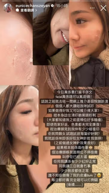 TVB小花升級做富貴人妻後被批離地無常識，自爆不知港鐵入閘要收錢
