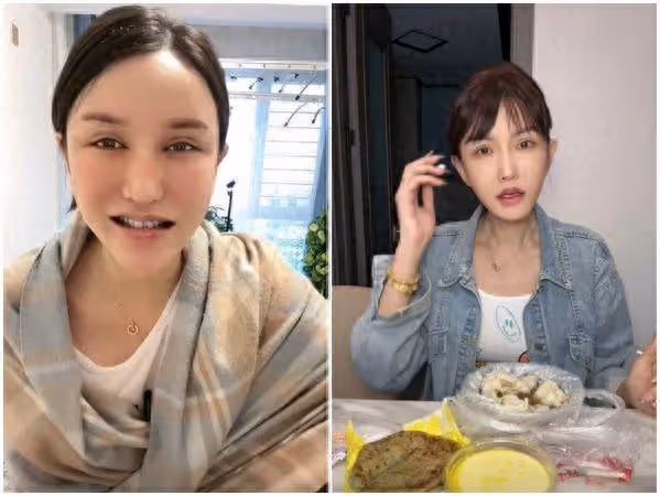砸590萬整形失敗! 陸網紅一笑「臉歪嘴斜」後悔:沒回頭路可走