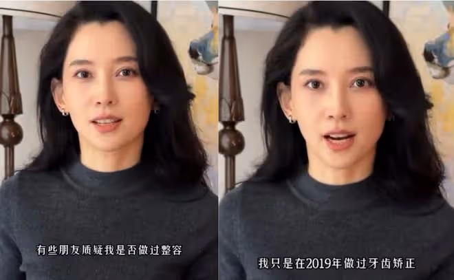 森林北回應和汪峰戀情,承認離異帶娃,否認整容,贊汪峰純粹傳統