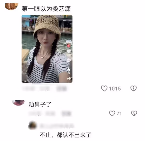 臉僵鼻子怪,嘴歪下巴尖,從金晨到柳岩,明星動臉後遺症都出來了