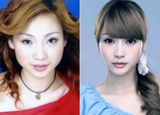 臉僵鼻子怪,嘴歪下巴尖,從金晨到柳岩,明星動臉後遺症都出來了
