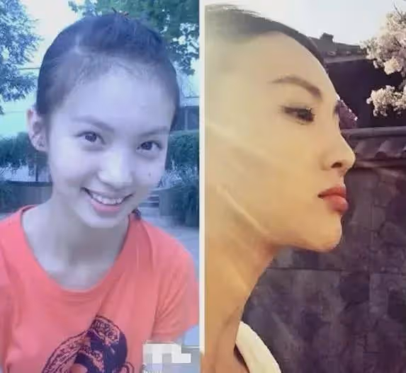 33歲的金晨,終於為自己的「整容」付出了代價