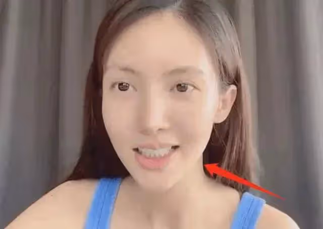 33歲的金晨,終於為自己的「整容」付出了代價