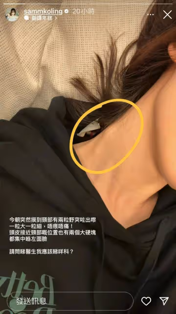 尷尬!TVB女星被錯認成高海寧,最近多位藝人被錯認是高海寧