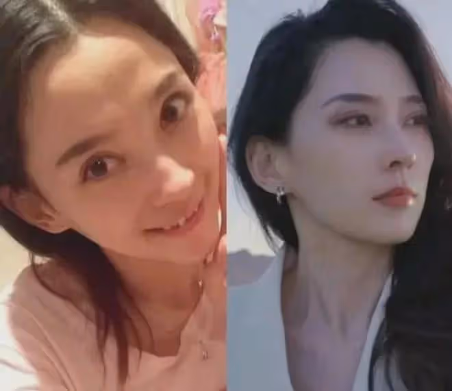 揭秘汪峰女友森林北被曝整容真實內幕