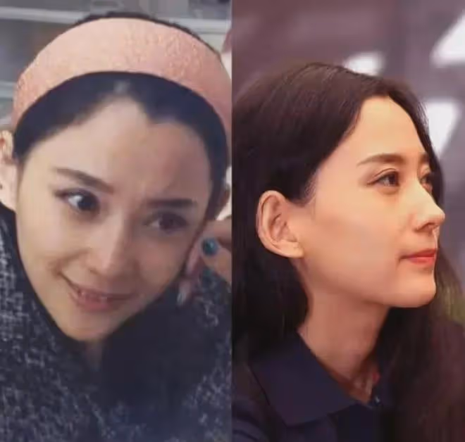 揭秘汪峰女友森林北被曝整容真實內幕
