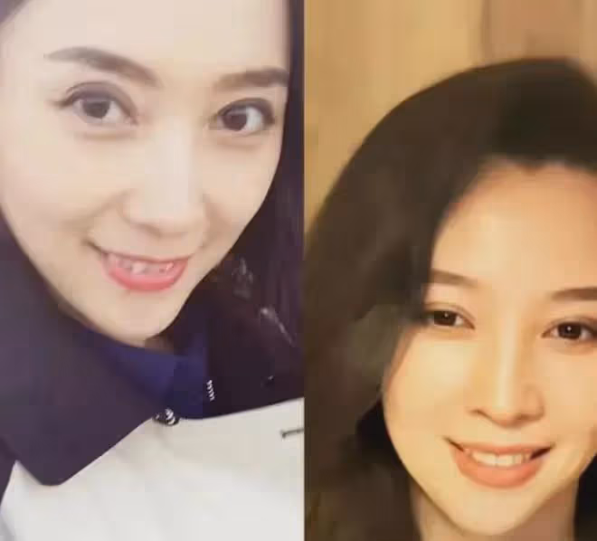 揭秘汪峰女友森林北被曝整容真實內幕