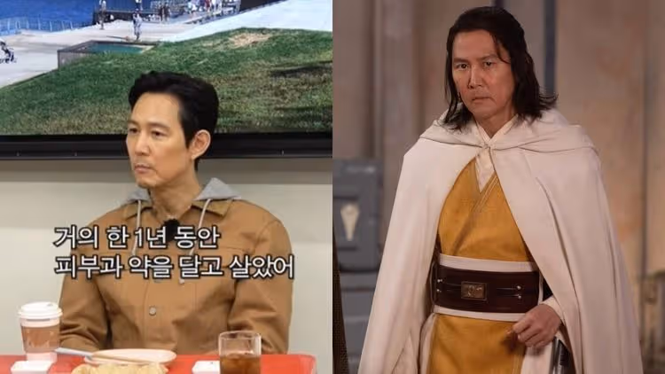 李政宰加盟《星戰》壓力山大！國外拍攝冒痘水腫「服用1年皮膚科藥」