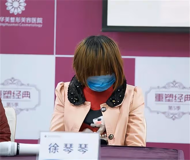 1996年,出生29天的女嬰被老鼠咬掉鼻子,與網戀帥小伙閃婚