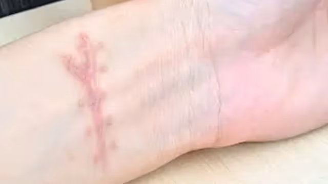 2011年,16歲少年欲輕生,19歲女孩以「女友」之名談判,一吻救命