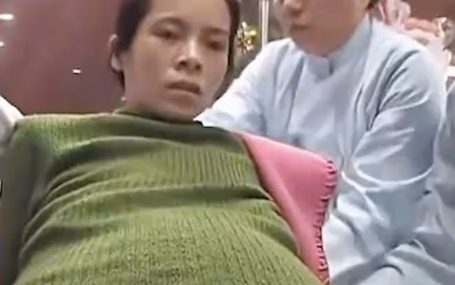09年廣東女子挺55公斤巨肚,懷孕11月未生,醫生檢查卻看不見孩子