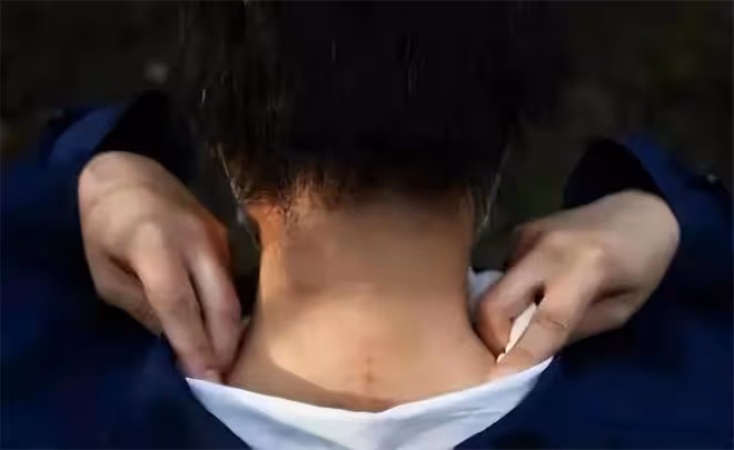2016年八達嶺老虎傷人案:倖存者索賠154萬失敗,因毀容無工作