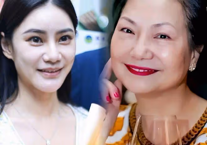 汪小菲額頭有抓痕，婚後直播馬筱梅未現身，馬筱梅長相撞臉S媽！