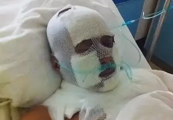 陳少華：因拒絕給伴舞簽名，被砍掉下巴毀容，如今淪落賣馬桶謀生