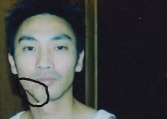 陳少華：因拒絕給伴舞簽名，被砍掉下巴毀容，如今淪落賣馬桶謀生