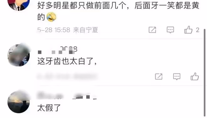 沙溢牙白到失真,金晨烤瓷牙出戲,明星假牙各有各的尷尬
