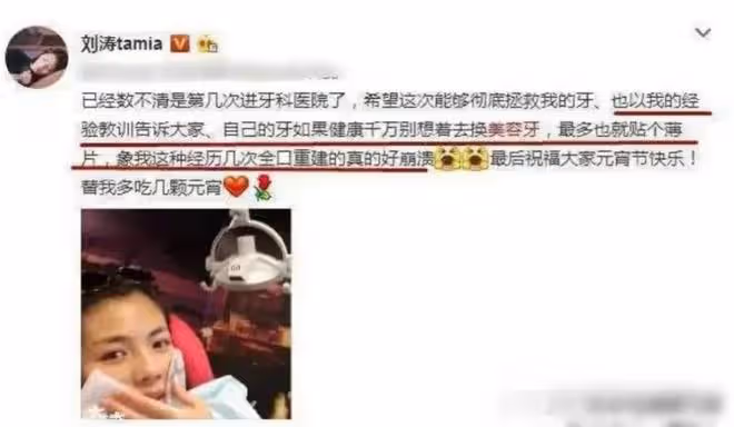 沙溢牙白到失真,金晨烤瓷牙出戲,明星假牙各有各的尷尬