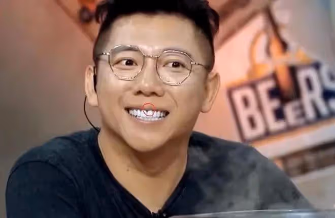 沙溢牙白到失真，金晨烤瓷牙出戲，明星假牙各有各的尷尬