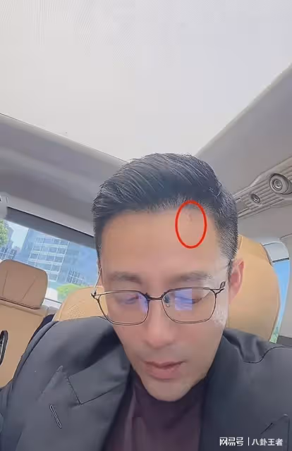 不出三年必離婚!新婚第二天汪小菲額頭現抓痕,看店馬筱梅未跟隨