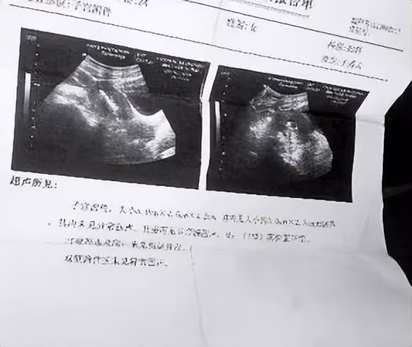 老闆墊付員工手術費,痊癒卻不辭而別,是忘恩負義還是另有隱情