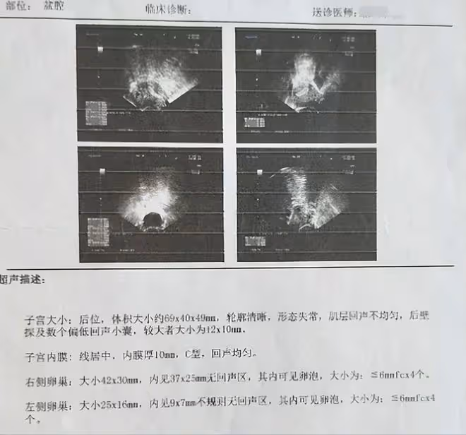 老闆墊付員工手術費,痊癒卻不辭而別,是忘恩負義還是另有隱情