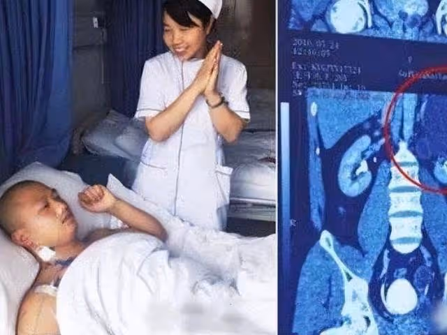 回顧:28歲男子力大無窮,檢查出有4個腎,妻子回應:他身體很好