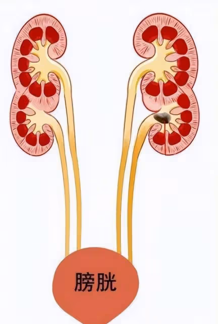 回顧:28歲男子力大無窮,檢查出有4個腎,妻子回應:他身體很好