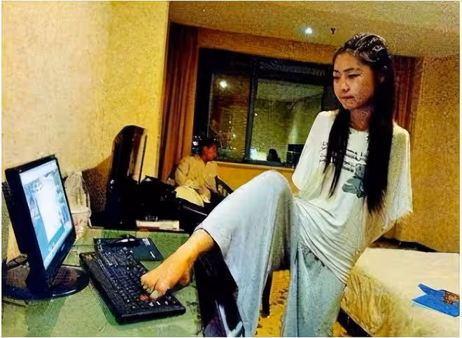 折翼天使楊佩:9歲失去雙臂,24歲創業當老闆,雙腳活出精彩人生
