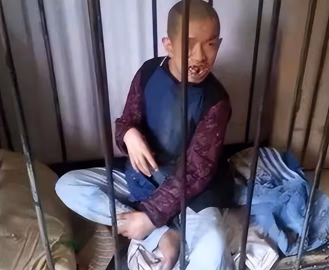 回顧:男子患怪病,被鎖籠子裡喂養,父親在他面前去世也無動於衷