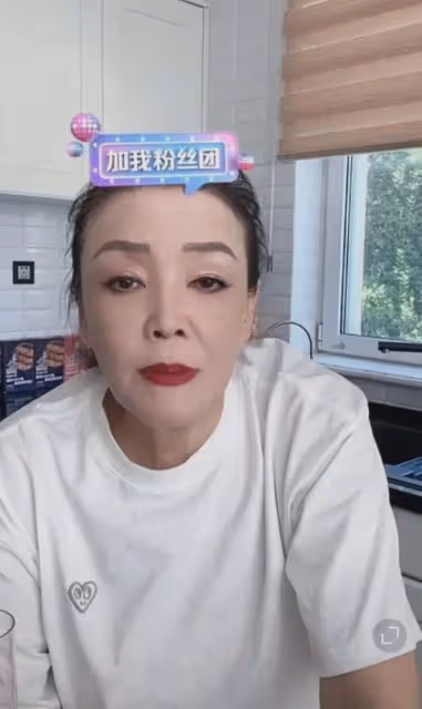 張蘭自爆患有白癜風，向網友展示患處仍堅持工作，網友直呼心疼！