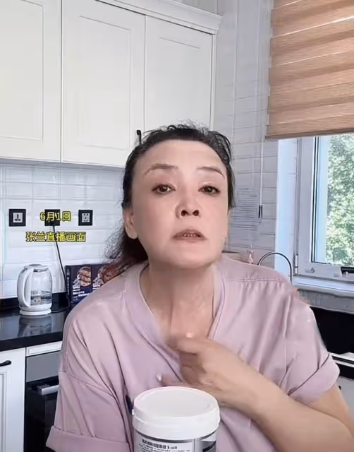 張蘭自爆患有白癜風，向網友展示患處仍堅持工作，網友直呼心疼！