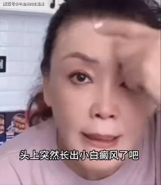 汪小菲兒子砸場麻六記,張蘭承認自己得了白癜風,大S終於服軟了