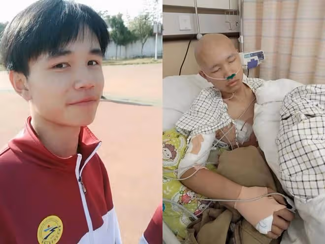 學霸男孩手上長疙瘩,一查竟已是癌症中晚期,灑淚揮別高考