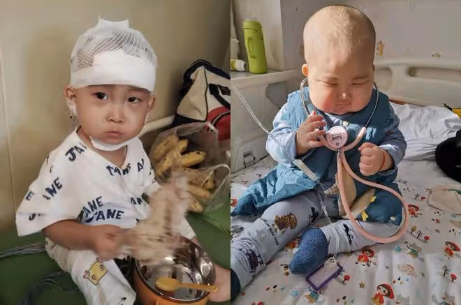 父母不信1歲半兒子得白血病,10天後基因突變,病情高危險釀大禍