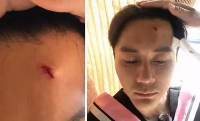 范丞丞發文回應傷情,粉絲留言心疼不已,網友:疼疼自己的爸媽吧
