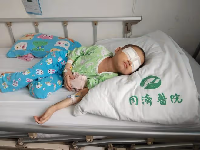 血癌女童結療後復發,移植排異奇癢難受突然拔掉picc管,父母嚇呆